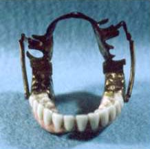 ウェッジウッド